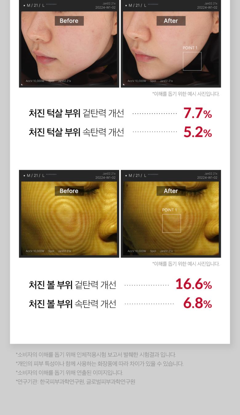 메디큐브 에이지알 더마 EMS 샷 + 전용 탄력 부스터 + 거치대 세트