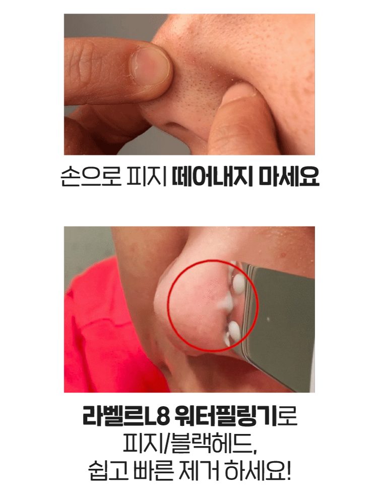 국산 아쿠아필링기 얼굴 코 피지 제거 워터필링 초음파 각질제거기 라벨르L8